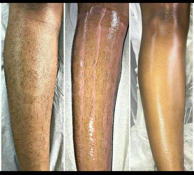 Legs before and after a body scrub and polish