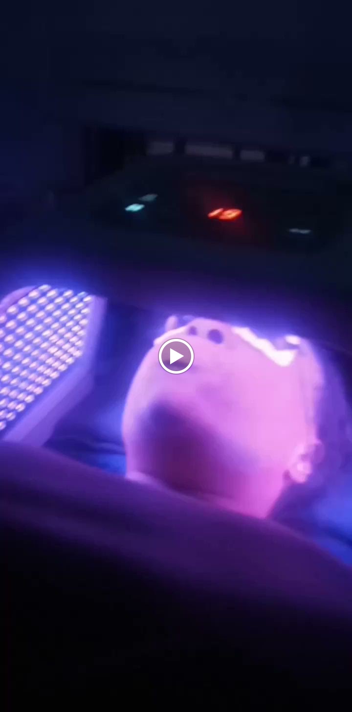 LED light treatment on the face