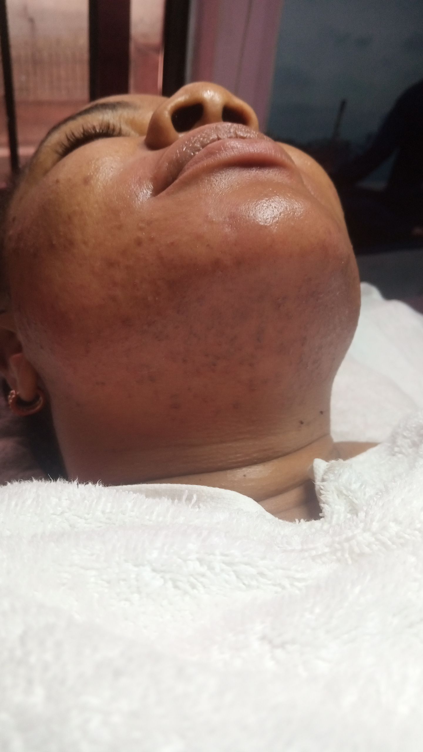 Smooth jawline after a chin wax