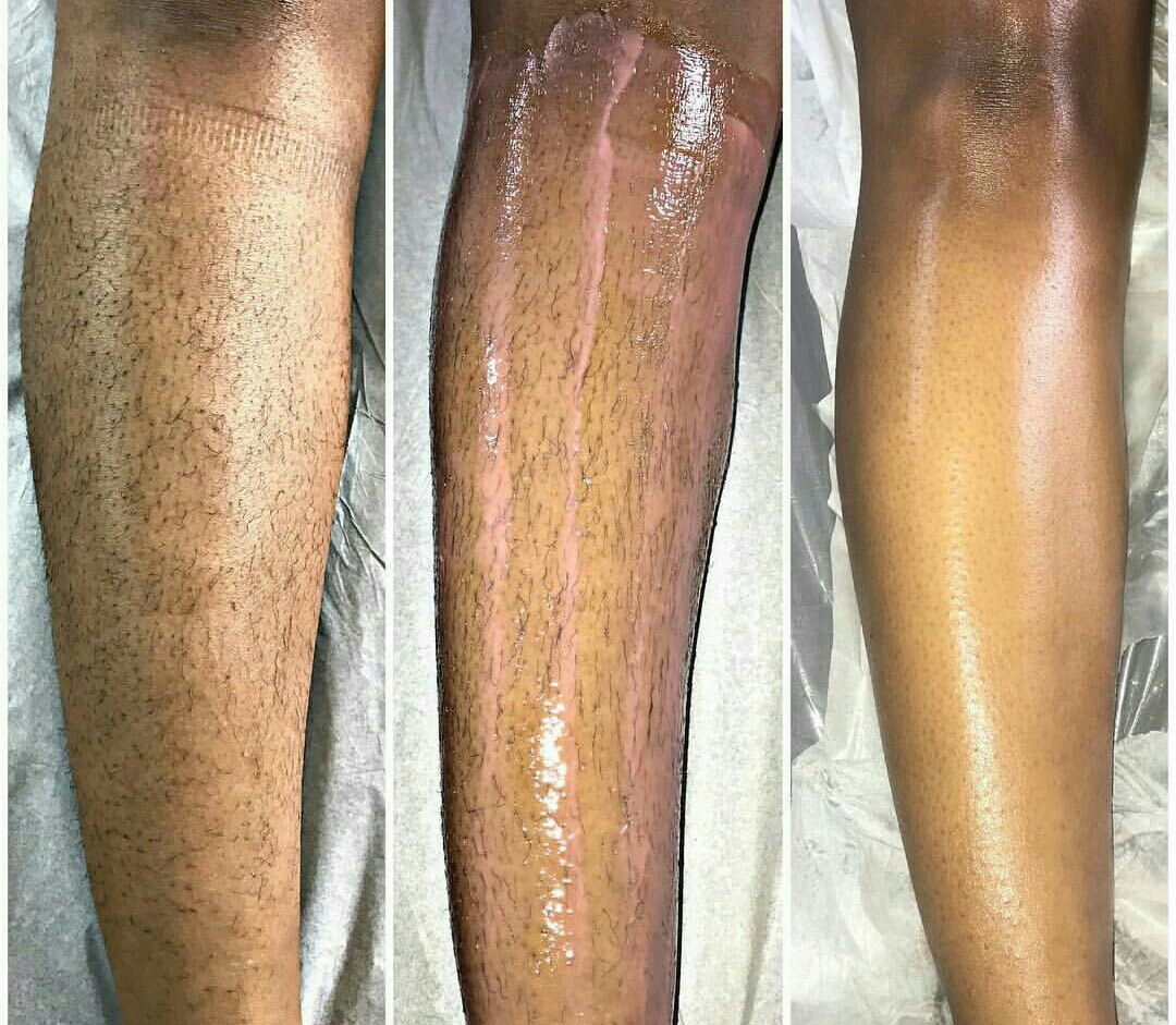 Legs before and after body polish