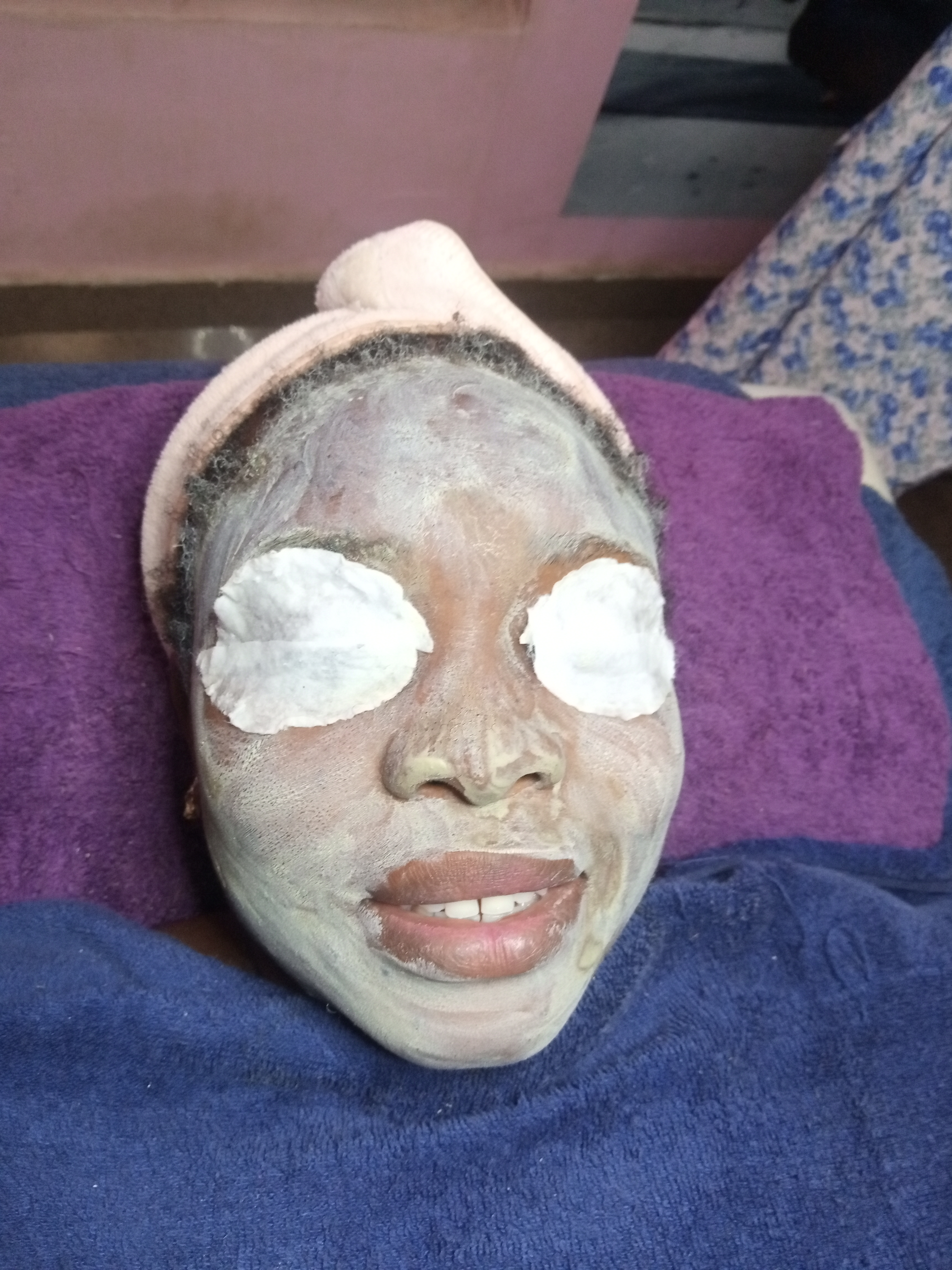 Client with a facial mask and eye pads