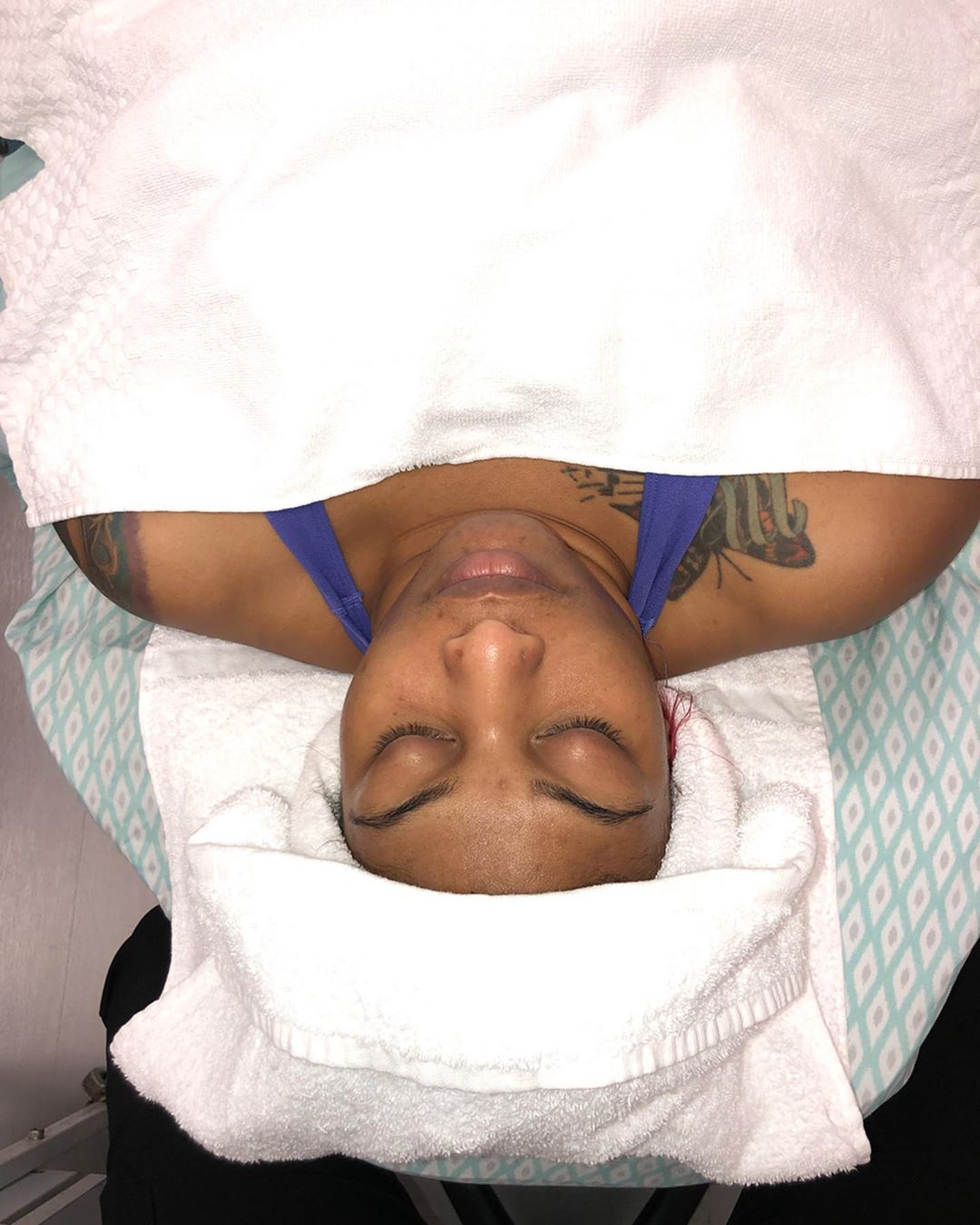 Client resting on the treatment bed with a towel