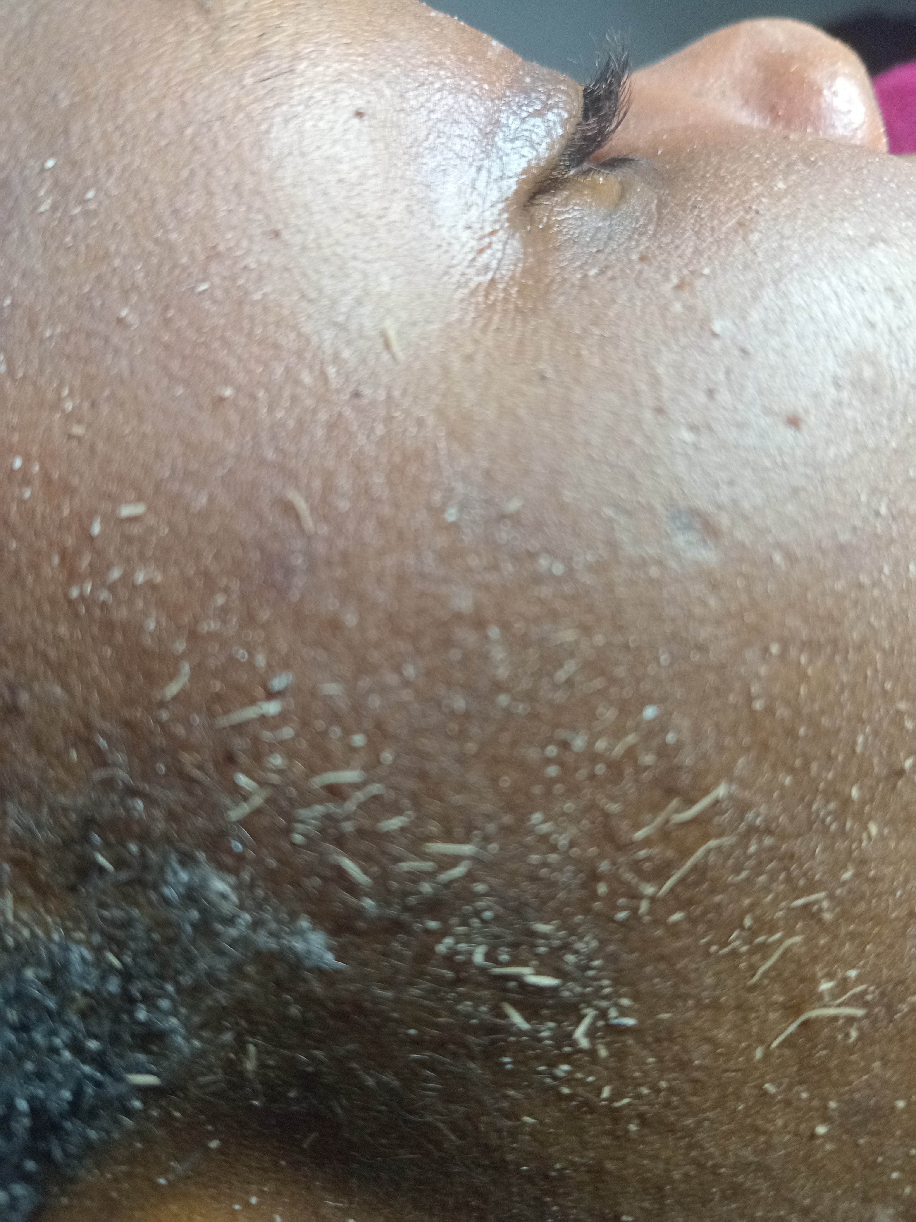 Chin hair before waxing